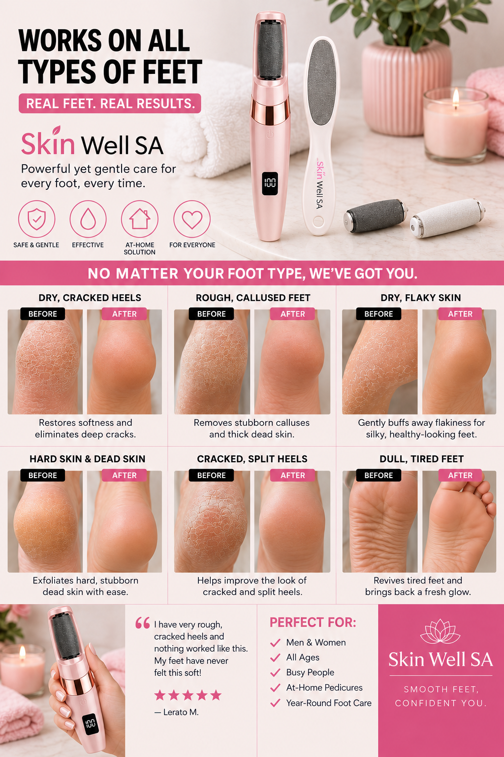 SoleSmooth™ Pro by Skin Well SA
